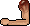 Severed Human Arm